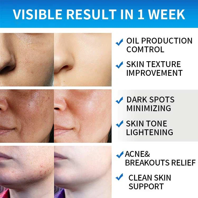 glycolic acid cleansing pads