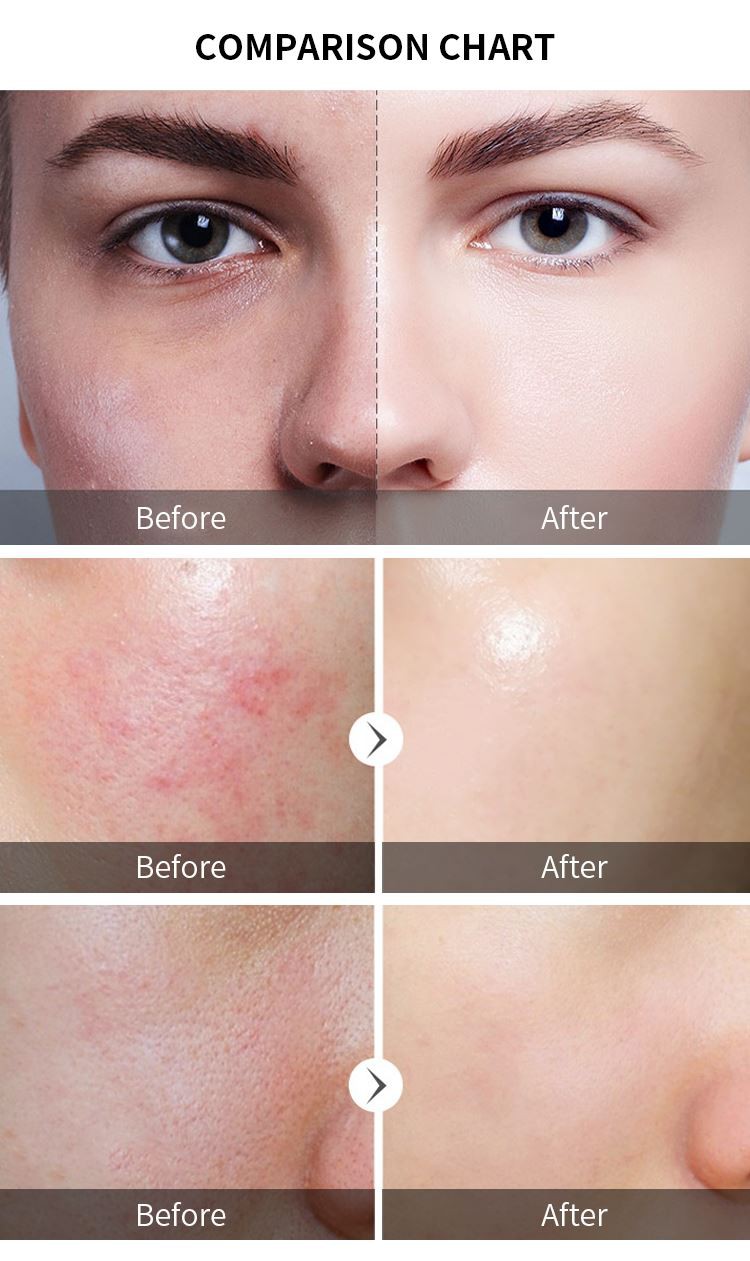 peeling smoothing aha bha serum