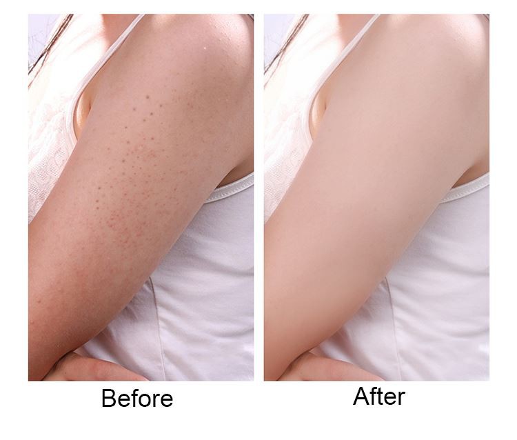 ultra moisturizing body lotion