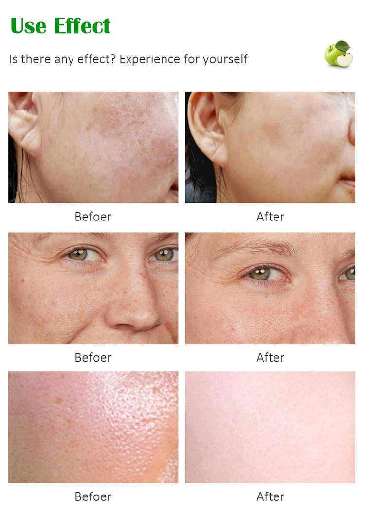 winter night cream for oily skin