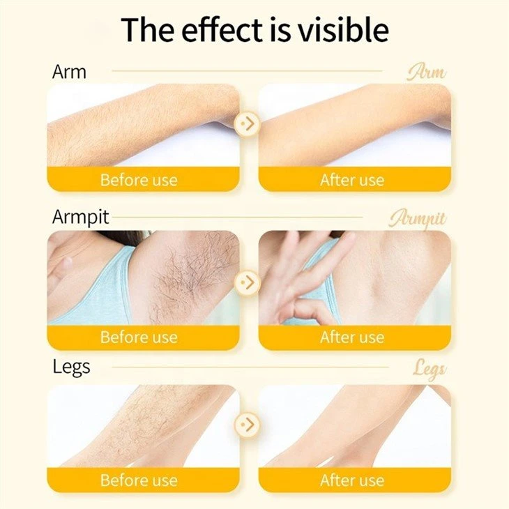 spray foam hair removal