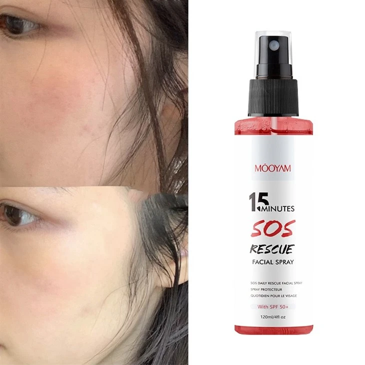 15 Minutes SOS Rescue Facial Spray