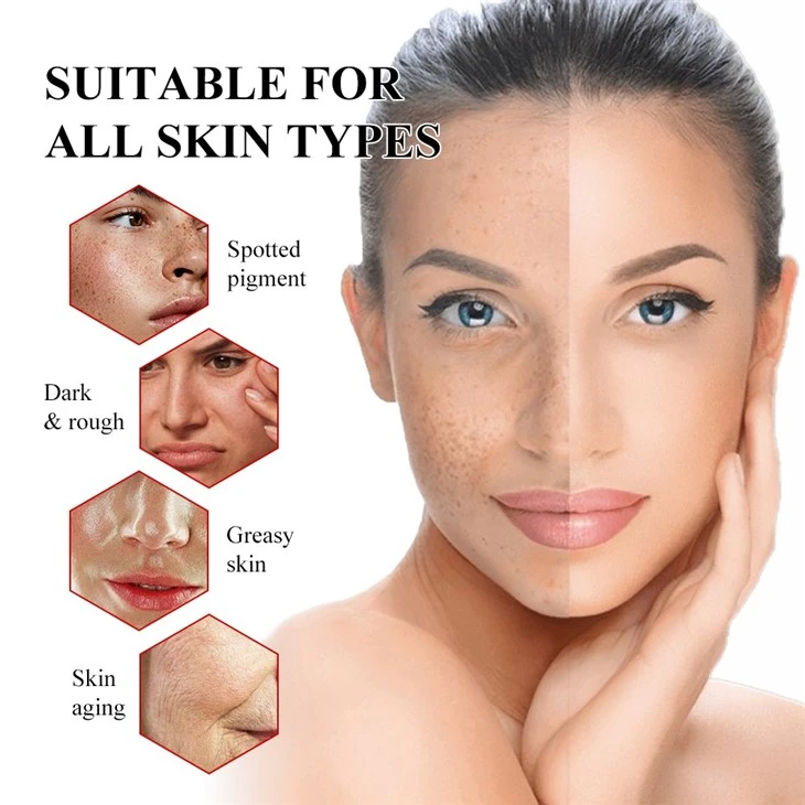 30ml 5% Niacinamide Facial Serum