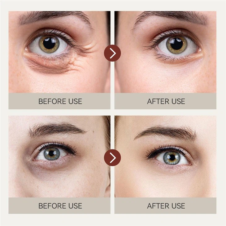 IREV RETINOL EYE CREAM