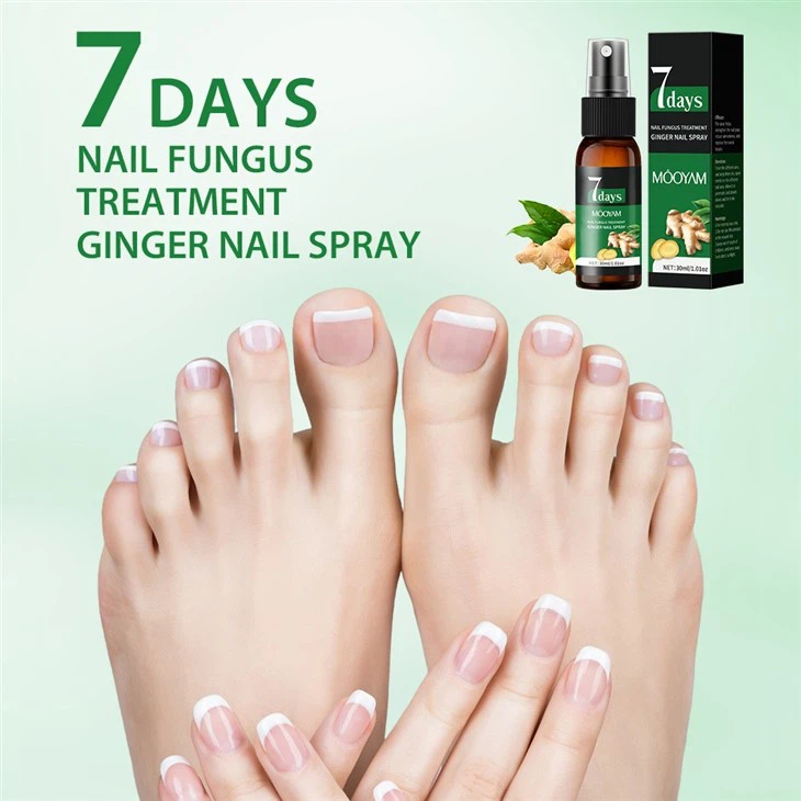 MOOYAM 7 Days Nail Fungus Treatment – Ginger Infused Nail Spray For Fast Relief