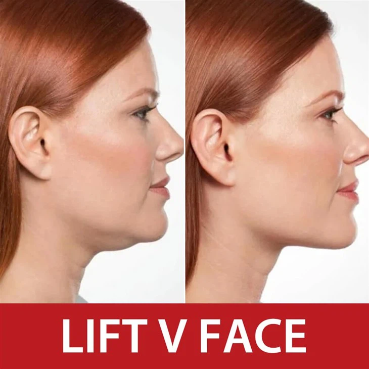 POLYPEPTIDE PROTEIN FIRMING & LIFTING MASK